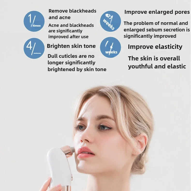 Aspirador de Poros Elétrico USB | Remove Cravos e Acne com Sução Recarregável