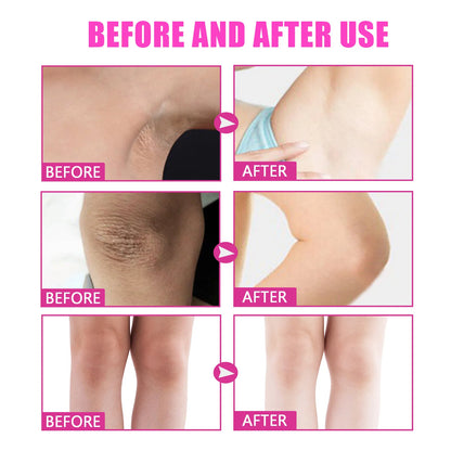 Creme Clareador Corporal | Para Joelhos, Virilha, Axilas e Zonas Íntimas
