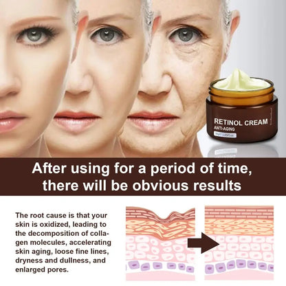 Creme Sérum Retinol 30g Facial Olhos – Firmeza Lifting Anti-Idade Reduz Rugas Linhas Finas