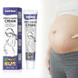 Creme Remoção Estrias Gravidez – Anti-Rugas Firmeza Reparador Hidratante Maternidade Pele Suave Corpo