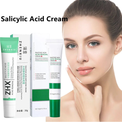 Creme Ácido Salicílico Redução de Poros | Remove Cravos e Suaviza a Pele