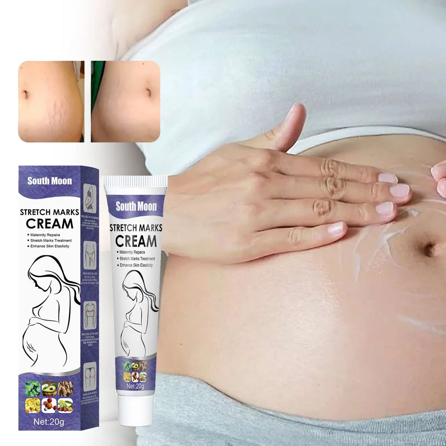 Creme Remoção Estrias Gravidez – Anti-Rugas Firmeza Reparador Hidratante Maternidade Pele Suave Corpo