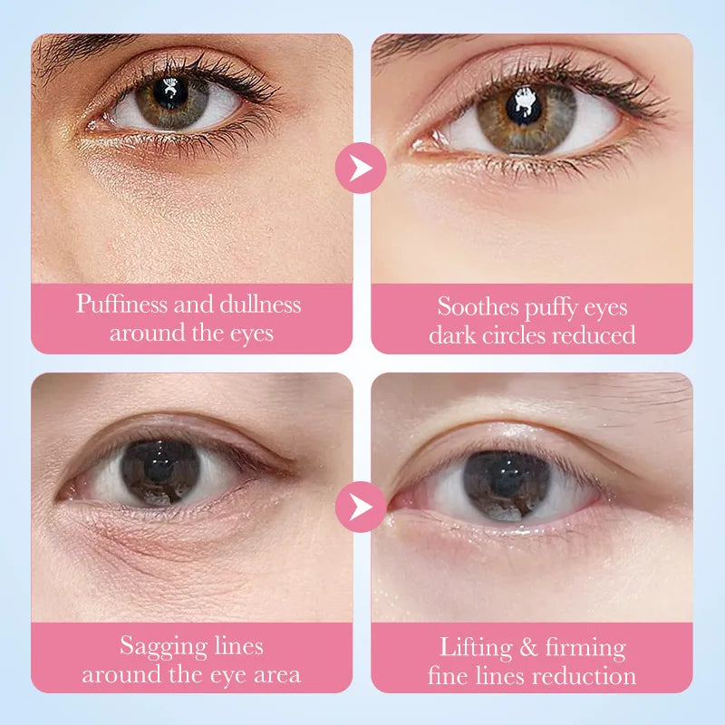 Máscaras Olhos SADOER Sakura Colágeno 60un – Anti-Olheiras Bolsas Hidratante Firmeza