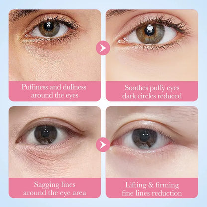 Máscaras Olhos SADOER Sakura Colágeno 60un – Anti-Olheiras Bolsas Hidratante Firmeza