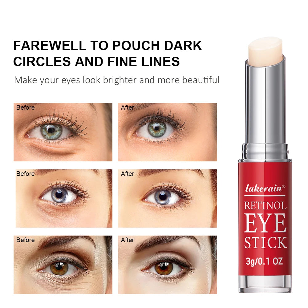 Creme de Olhos Retinol Stick | Reduz Olheiras e Firma a Pele ao Redor dos Olhos