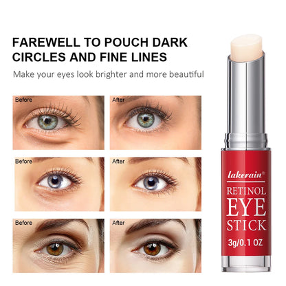 Creme de Olhos Retinol Stick | Reduz Olheiras e Firma a Pele ao Redor dos Olhos