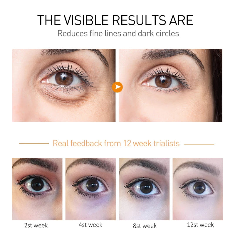 Creme Olhos OCHEAL Hidratante – Linhas Finas Olheiras Sérum Bolsas Inchaço Anti-Idade Firmeza