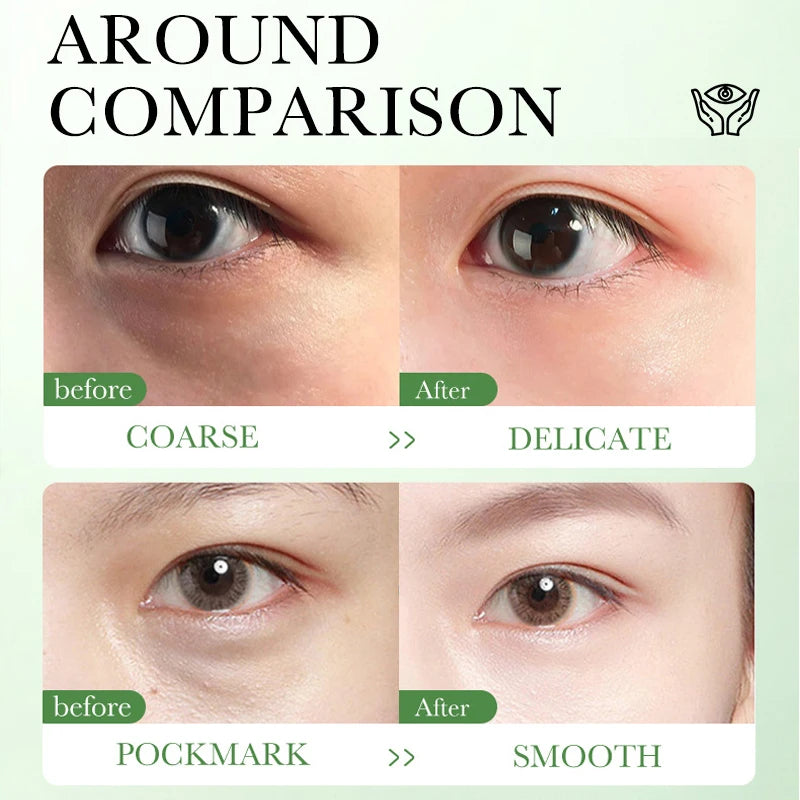 Creme Olhos Centella Asiatica – Hidratante Firmeza Clareia Olheiras Suaviza Linhas Nutre 20g