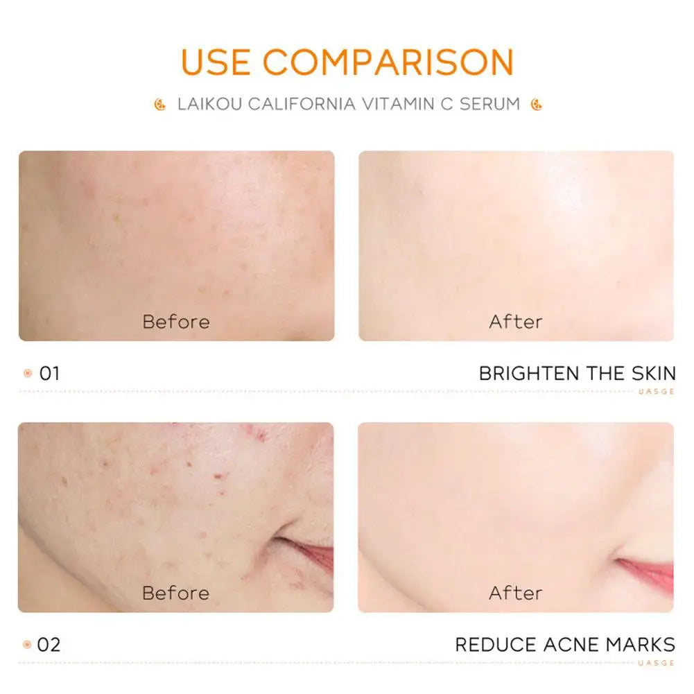 Sérum Vitamina C Ácido Hialurónico Rosto – Colágeno Iluminador Lifting Firmeza Suaviza Linhas Finas Anti-Idade