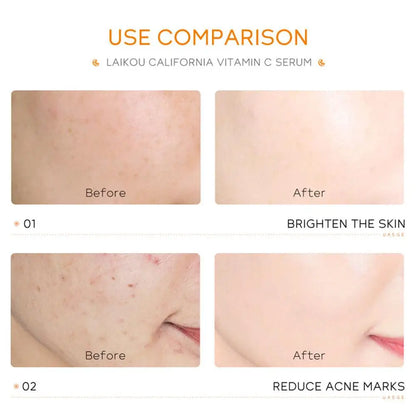 Sérum Vitamina C Ácido Hialurónico Rosto – Colágeno Iluminador Lifting Firmeza Suaviza Linhas Finas Anti-Idade