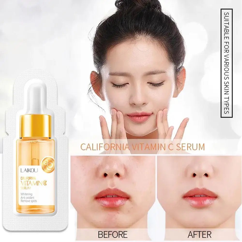Sérum Vitamina C Ácido Hialurónico Rosto – Colágeno Iluminador Lifting Firmeza Suaviza Linhas Finas Anti-Idade