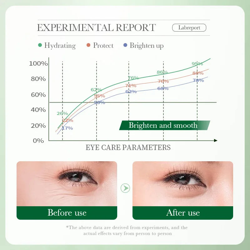 Creme Olhos Centella Asiatica – Hidratante Firmeza Clareia Olheiras Suaviza Linhas Nutre 20g