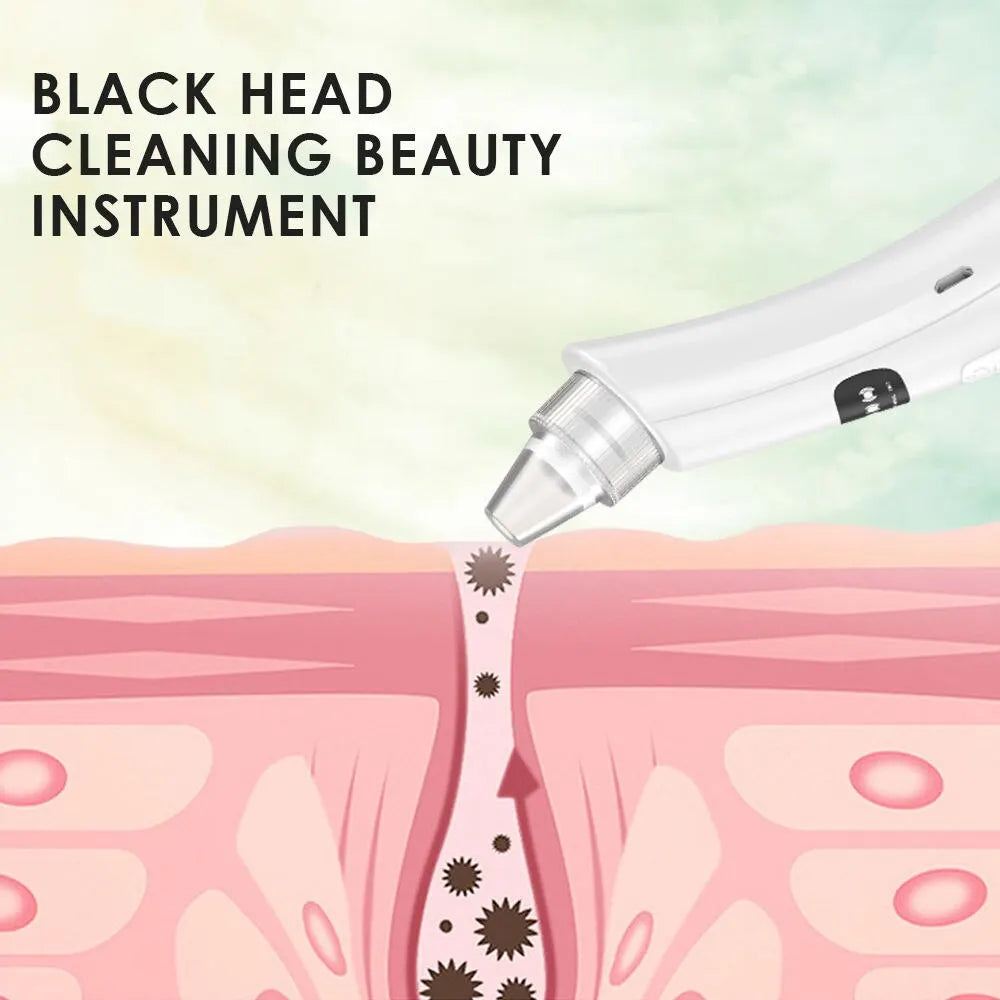 Máquina de Limpeza Facial com Vácuo | 3 Modos de Sução, Remove Cravos e Pele Morta