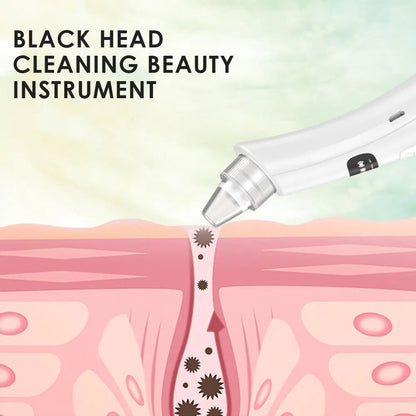 Máquina de Limpeza Facial com Vácuo | 3 Modos de Sução, Remove Cravos e Pele Morta