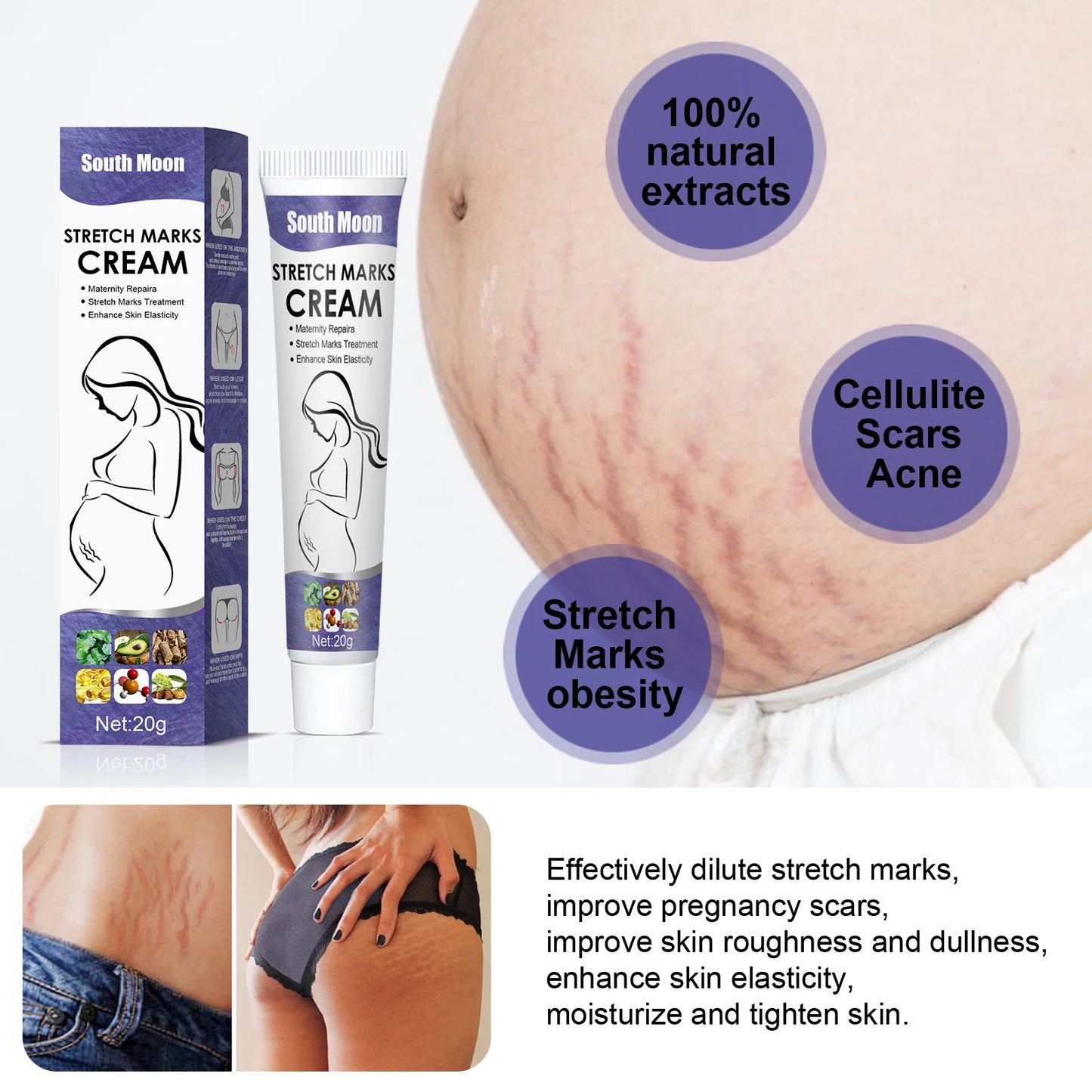 Creme Remoção Estrias Gravidez – Anti-Rugas Firmeza Reparador Hidratante Maternidade Pele Suave Corpo