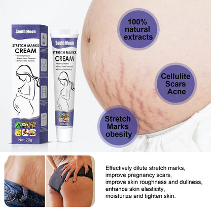 Creme Remoção Estrias Gravidez – Anti-Rugas Firmeza Reparador Hidratante Maternidade Pele Suave Corpo