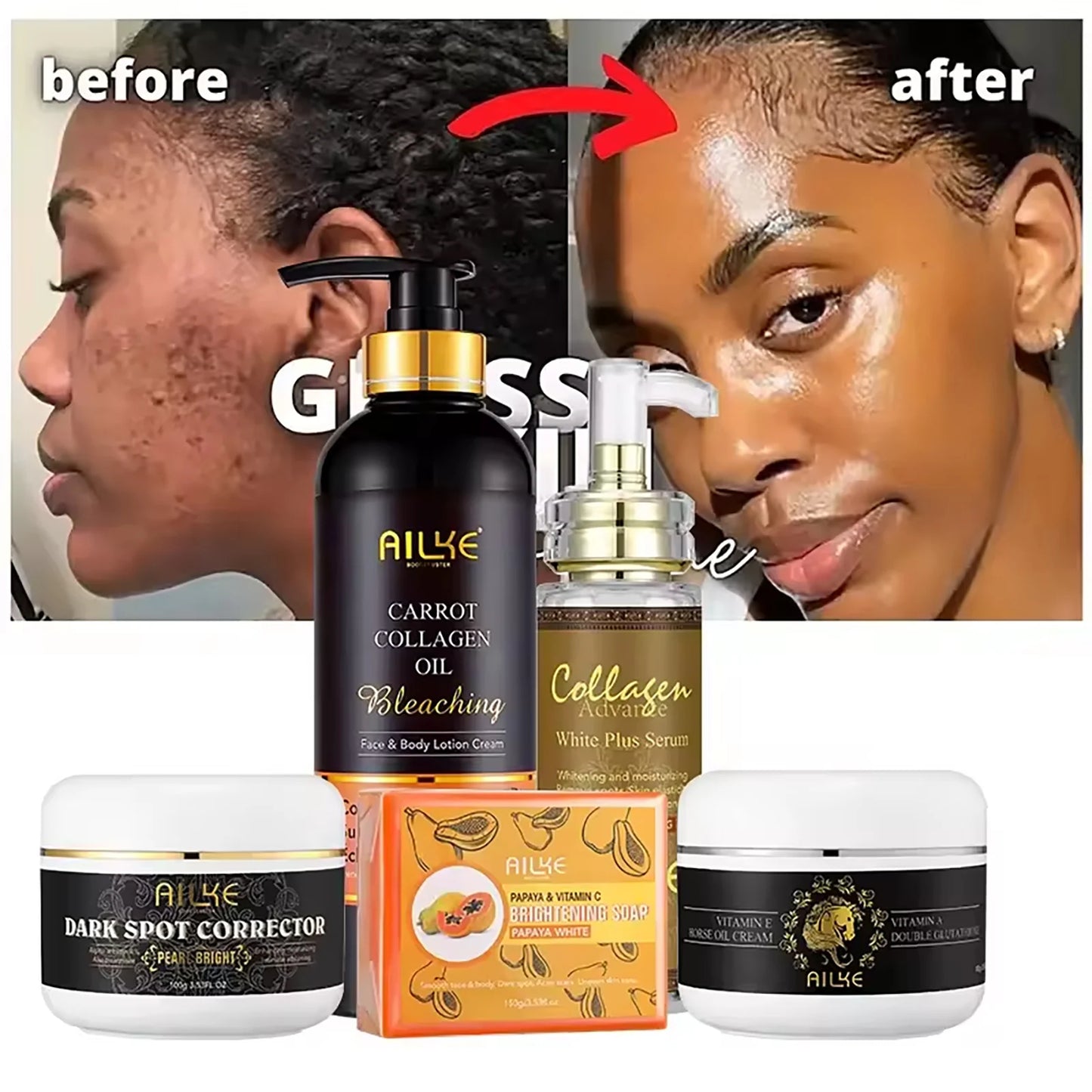 AILKE Kit Premium 5 em 1 Colágeno – Tratamento Anti-Idade Profissional Hidrata Clareia Rejuvenesce