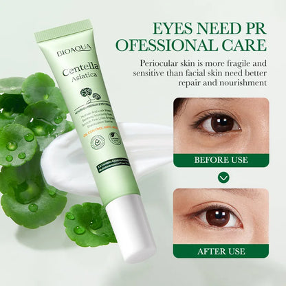 Creme Olhos Centella Asiatica – Hidratante Firmeza Clareia Olheiras Suaviza Linhas Nutre 20g