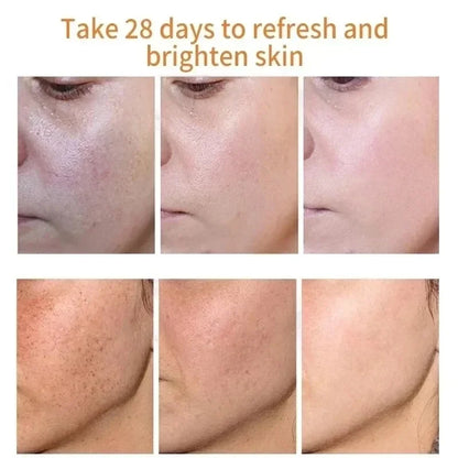 Creme Facial Clareia Sardas e Manchas Escuras | Niacinamida e Vitamina E Iluminador