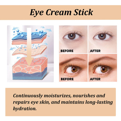Creme Olhos Stick Caracol Colágeno – Suaviza Linhas Finas Rugas Clareia Olheiras Firma Bolsas Inchaço Hidratante