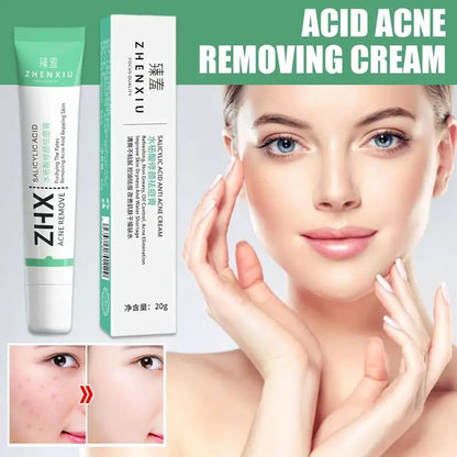 Creme Ácido Salicílico Redução de Poros | Remove Cravos e Suaviza a Pele