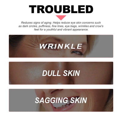 Creme Olhos Retinol Anti-Rugas – Firmeza Lifting Olheiras Bolsas Hidratante Clareador Iluminador