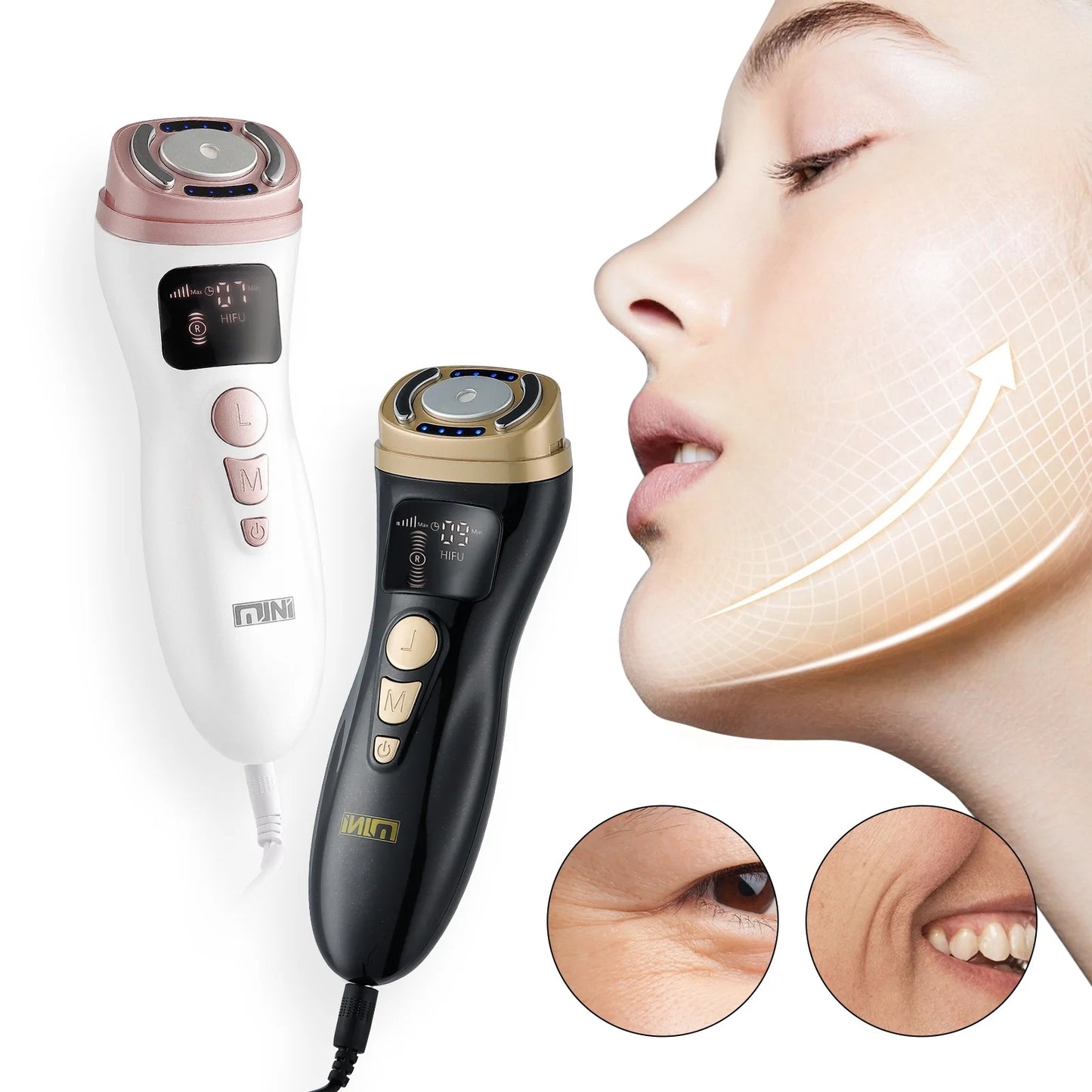 Mini Máquina HIFU Ultrassónica RF EMS | Lifting Facial, Antirrugas e Tonificação da Pele