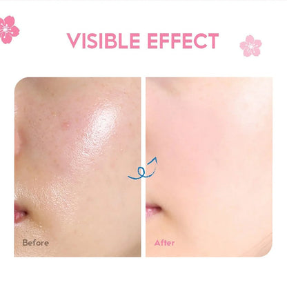 Creme de Essência de Sakura Japonês com Ácido Hialurónico | Hidratação e Luminosidade