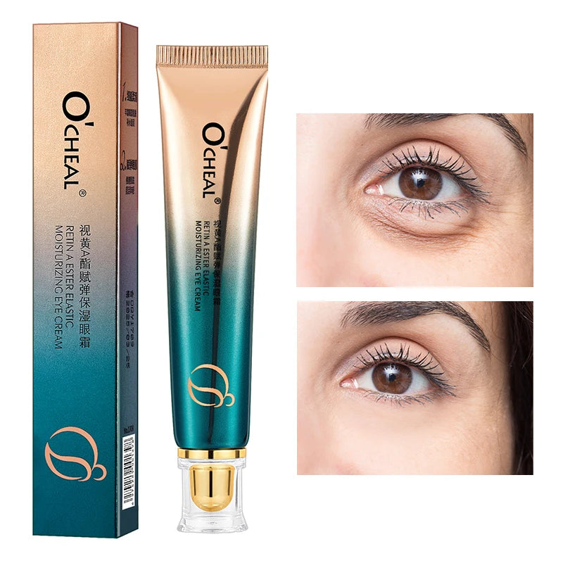 Creme Olhos OCHEAL Hidratante – Linhas Finas Olheiras Sérum Bolsas Inchaço Anti-Idade Firmeza