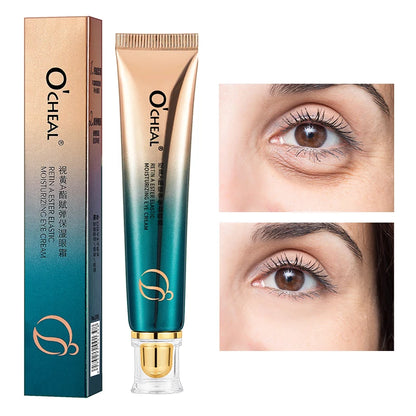 Creme Olhos OCHEAL Hidratante – Linhas Finas Olheiras Sérum Bolsas Inchaço Anti-Idade Firmeza