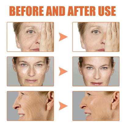 Sérum Facial JAYSUING Ácido Hialurónico Puro - Anti-Rugas Lifting Firmeza Contorno Olhos