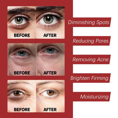 Creme Sérum Retinol 30g Facial Olhos – Firmeza Lifting Anti-Idade Reduz Rugas Linhas Finas