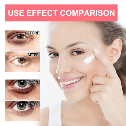 Creme Olhos Retinol Anti-Rugas – Firmeza Lifting Olheiras Bolsas Hidratante Clareador Iluminador