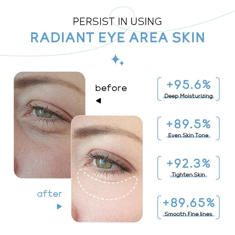 Creme Olhos LAIKOU Leite 20g – Olheiras Bolsas Firmeza Reduz Inchaço Hidratante Contorno Olhos
